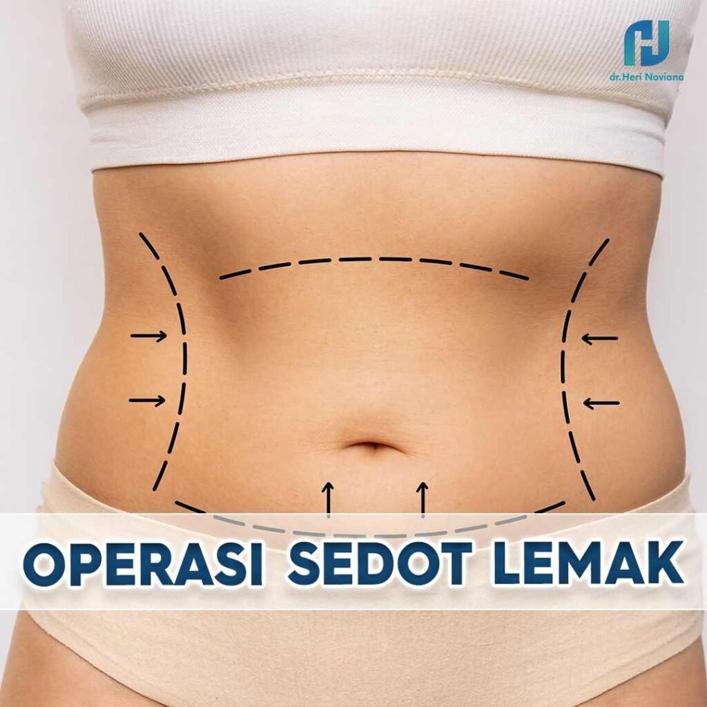 SEDOT LEMAK JAKARTA