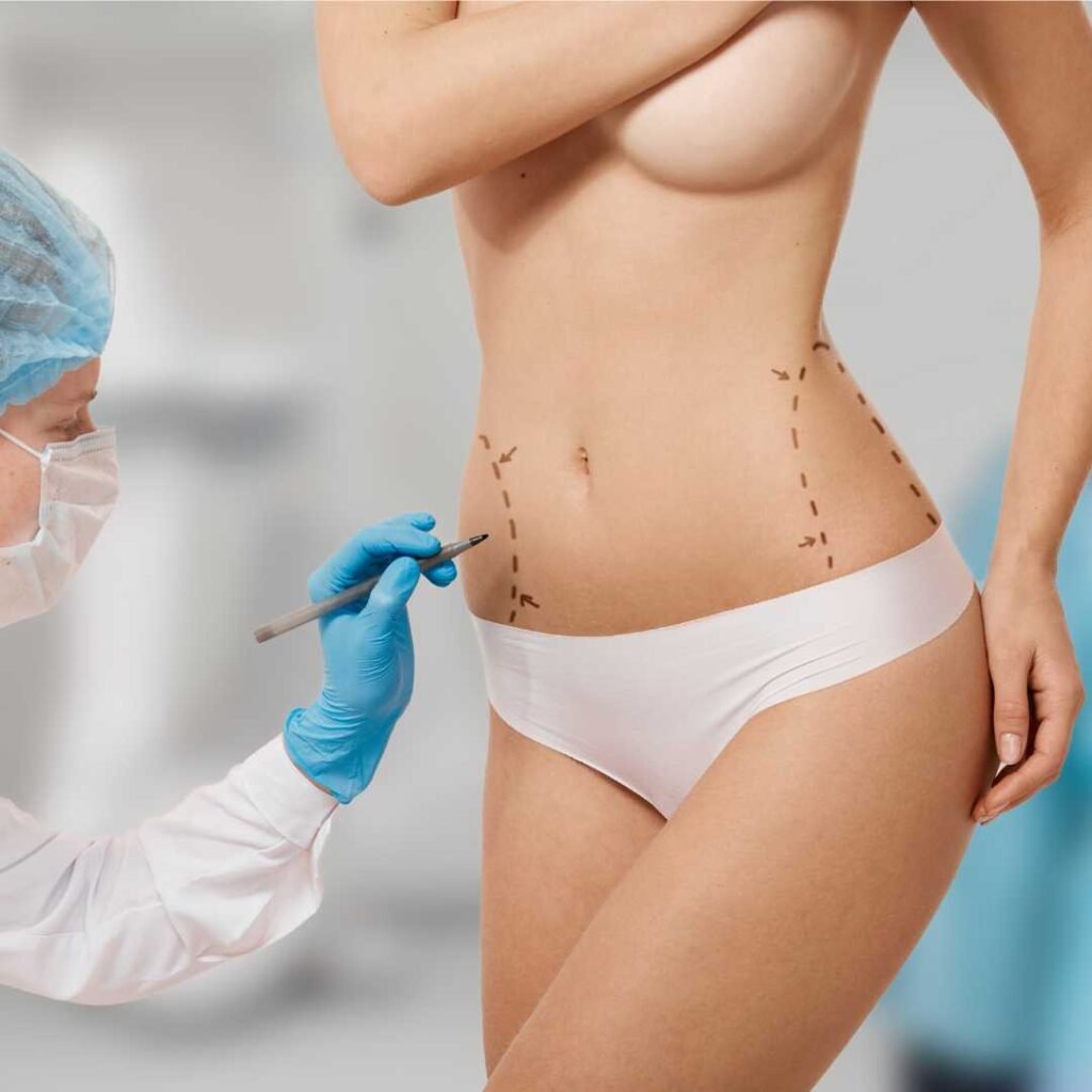 sedot lemak liposuction dr. Heri Noviana Sp.BP-RE, M. Ked Klin.